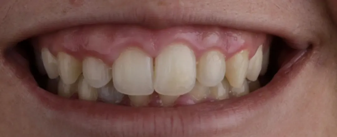 Caso 7: o mesmo sorriso antes